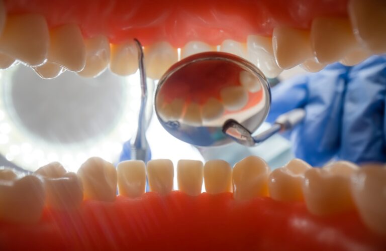 Krwawiące dziąsła – kiedy udać się do periodontologa? 1 Krwawiące dziąsła – kiedy udać się do periodontologa