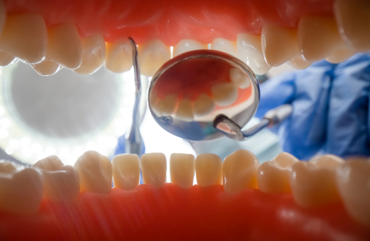 Krwawiące dziąsła – kiedy udać się do periodontologa